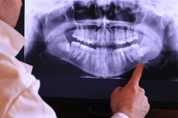Best Broken or Chipped Tooth Repair in Richton, MS