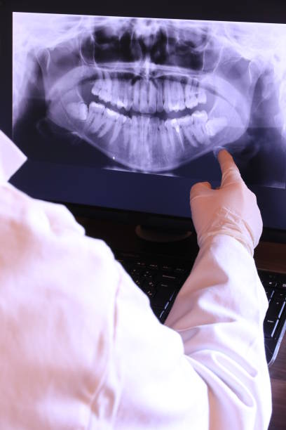 Best Knocked-Out Tooth (Avulsed Tooth) Treatment in Richton, MS