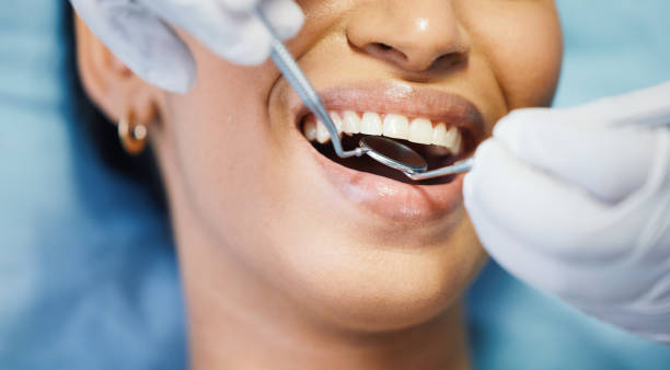 Best Broken or Chipped Tooth Repair in Richton, MS
