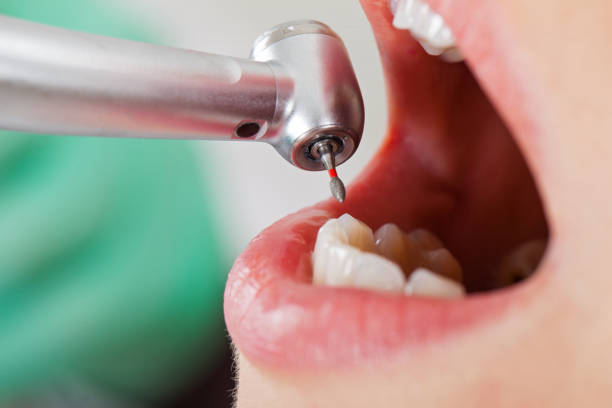 Best Emergency Dental Care for Sports Injuries in Richton, MS